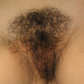 Hairy